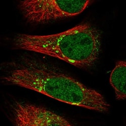 BET1L Antibody, Novus Biologicals 25 &mu;L, Unlabeled:Antibodies, Polyclonal